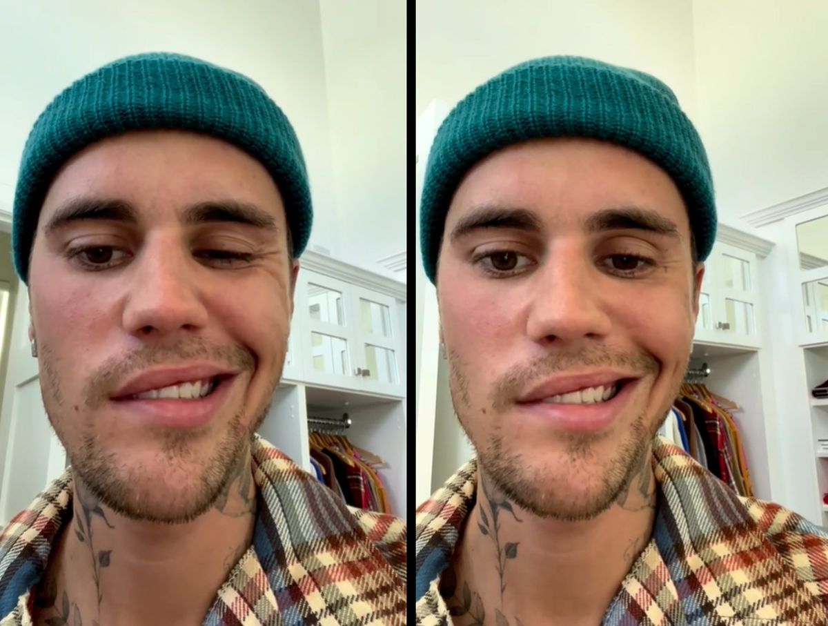 Explained | What is Ramsay Hunt syndrome, the disorder affecting Justin  Bieber? - The Hindu